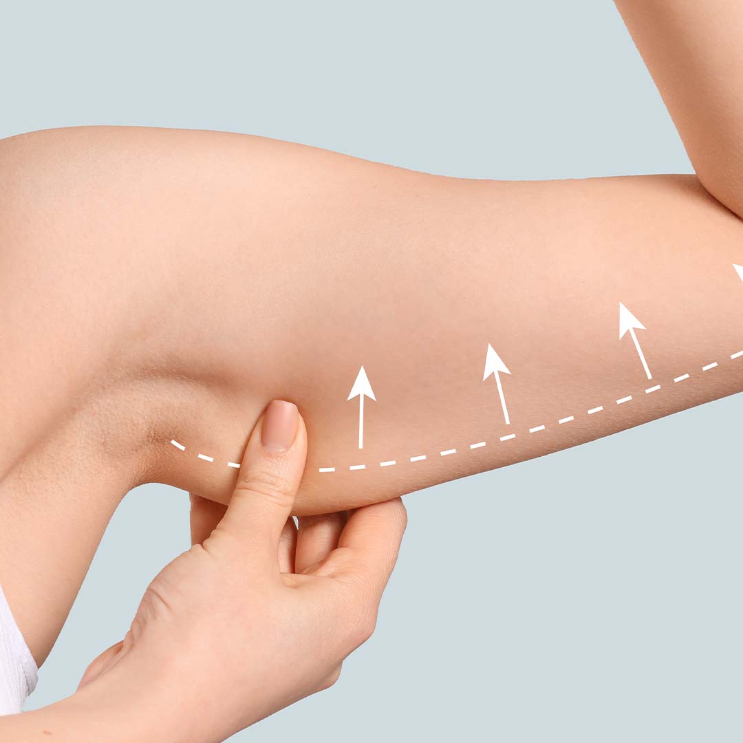 Arm Skin Tightening