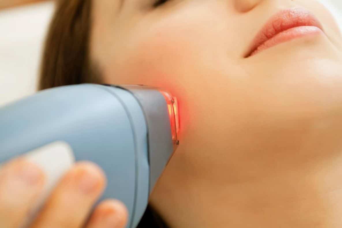 إزالة الشعر نهائيا