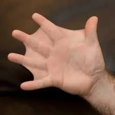 عمليات تجميل التشوهات باليد