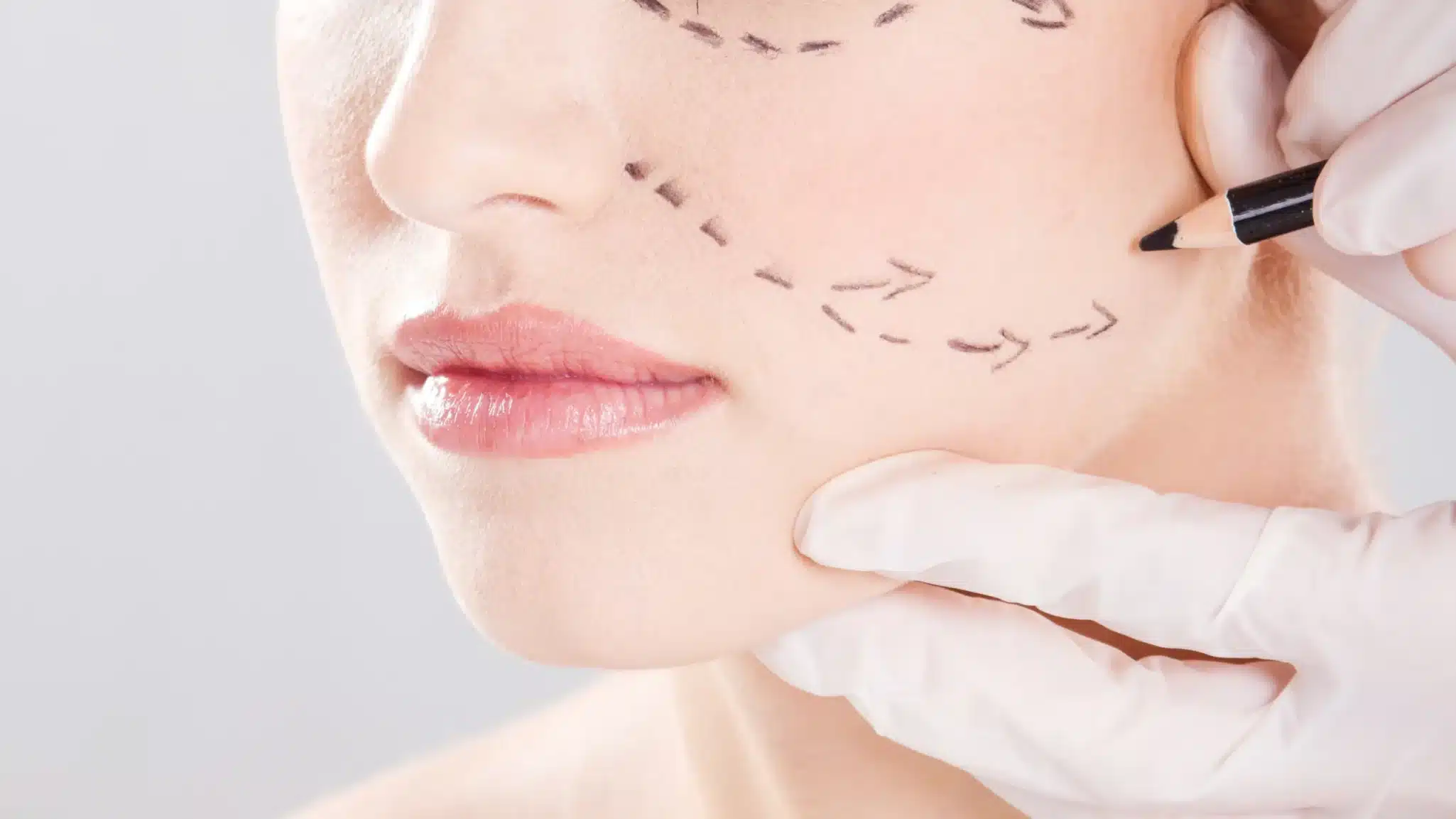 Endoscopic deep facelift شد الوجه العميق بالمنظار لاستعادة شبابك