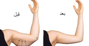 نحت الذراعين
