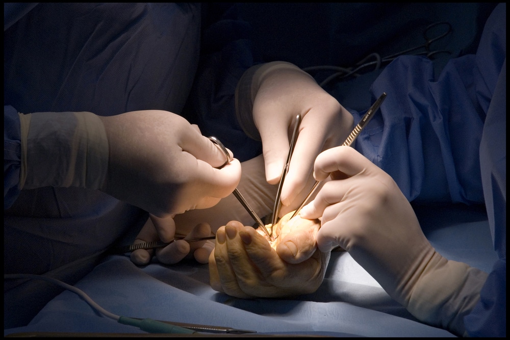 عمليات تجميل التشوهات باليد