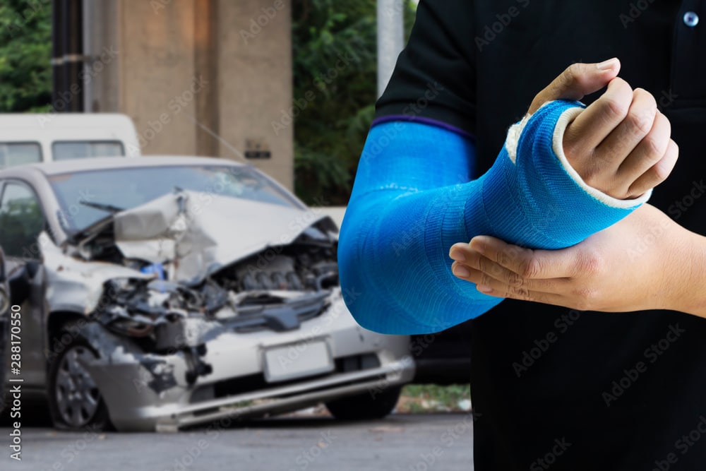 تشوهات الحوادث