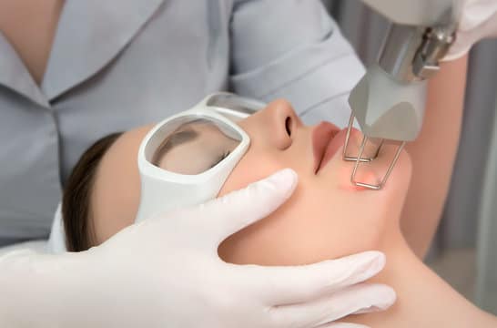 laser facial beautification
