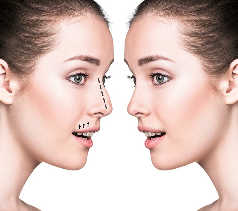 تجميل الوجه والأنف