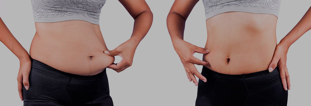 علاج السمنة في المراكز التجميلية