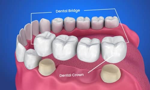 Cosmetic Dentistry 
