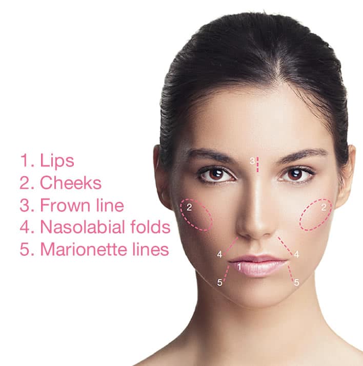 Filler for Face