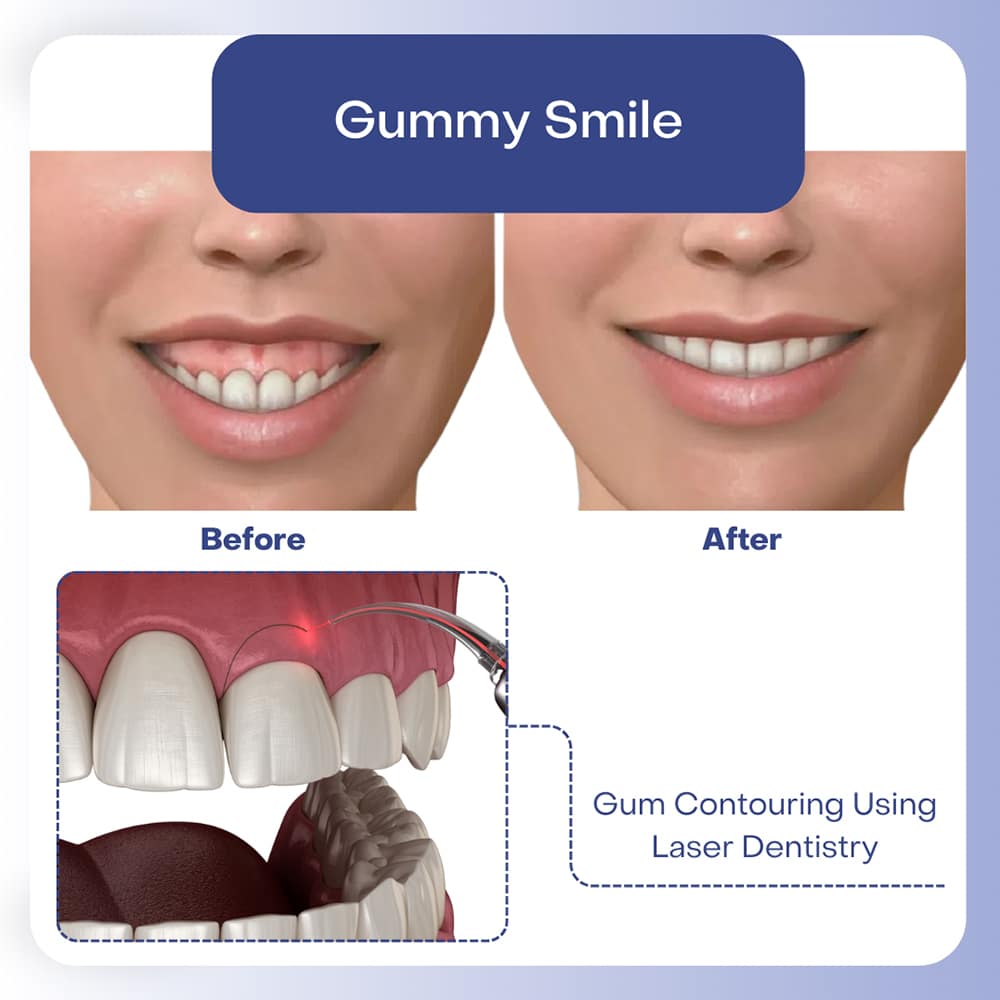 Cosmetic Dentistry 